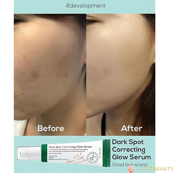 AXIS-Y Dark Spot Correcting Glow Serum (big size 50ml)