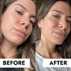 CeraVe Blemish Control Gel Moisturiser with 2% Salicylic Acid & Niacinamide for Blemish-Prone Skin 40ml