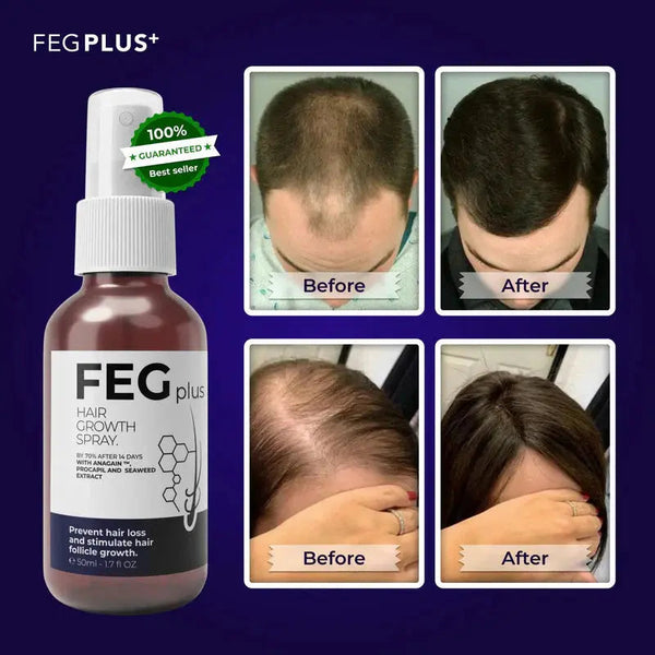 FEG Plus Hair Growth Spray( Buy One Get One Free ) (Copy)