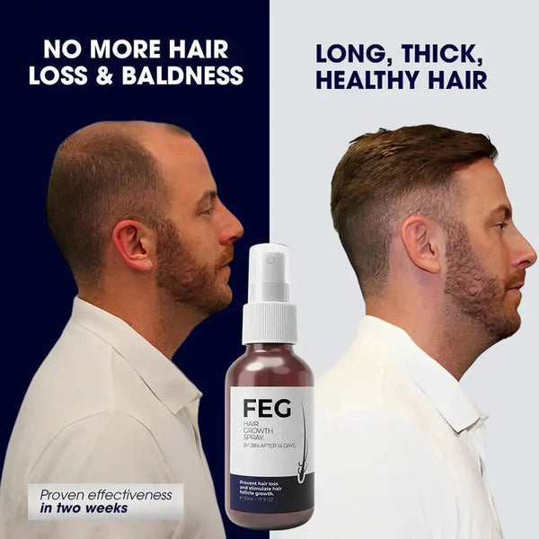 FEG Plus Hair Growth Spray( Buy One Get One Free ) (Copy)