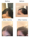 75% Off Abyssal Hair Revival & Growth Oil regernate