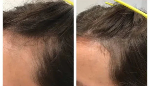 75% Off Abyssal Hair Revival & Growth Oil regernate